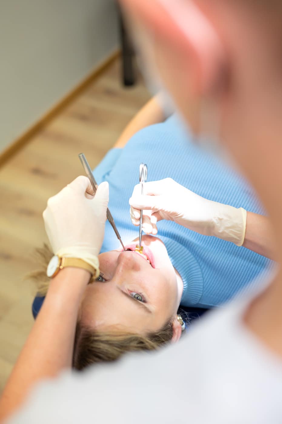 Zahnkorrektur - Meine Aligner Behandlung mit Spark startet